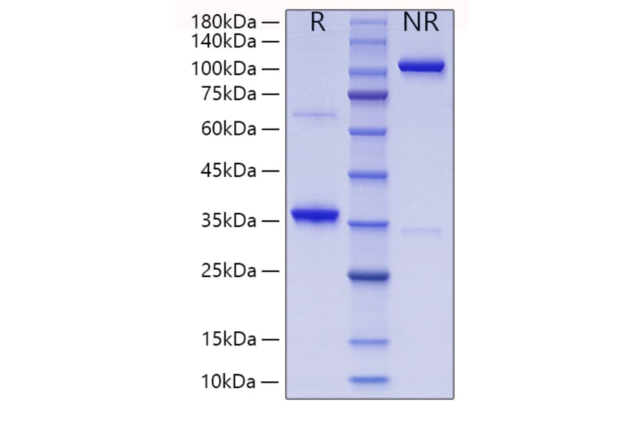 SDS-PAGE - Recombinant Human Collagen II Protein (N-terminal His Tag) (A330475) - Antibodies.com