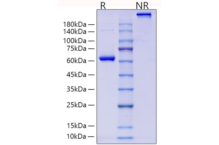 SDS-PAGE - Recombinant Human Collagen II Protein (N-terminal Human Fc Tag) (A330476) - Antibodies.com