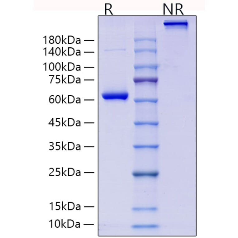 SDS-PAGE - Recombinant Human Collagen II Protein (N-terminal Human Fc Tag) (A330476) - Antibodies.com