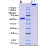 SDS-PAGE - Recombinant Human Collagen II Protein (N-terminal Human Fc Tag) (A330476) - Antibodies.com