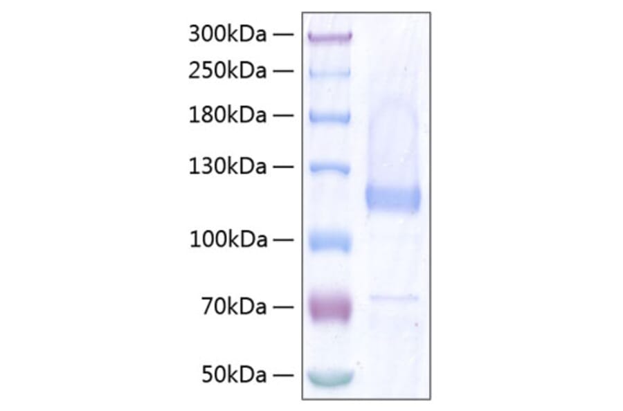 SDS-PAGE - Recombinant Human COMP Protein (C-terminal His Tag) (A330477) - Antibodies.com
