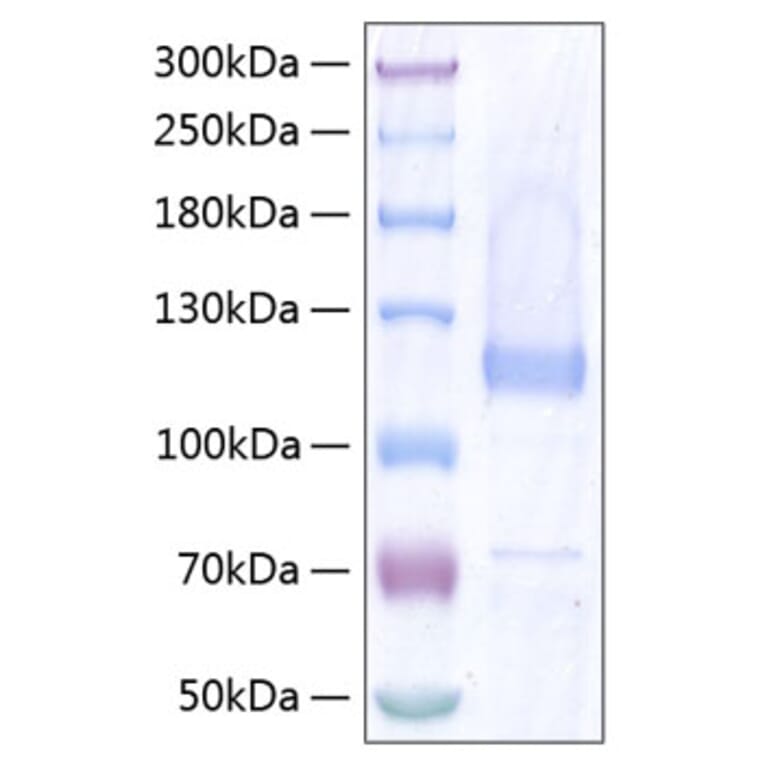 SDS-PAGE - Recombinant Human COMP Protein (C-terminal His Tag) (A330477) - Antibodies.com