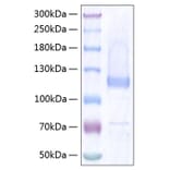 SDS-PAGE - Recombinant Human COMP Protein (C-terminal His Tag) (A330477) - Antibodies.com