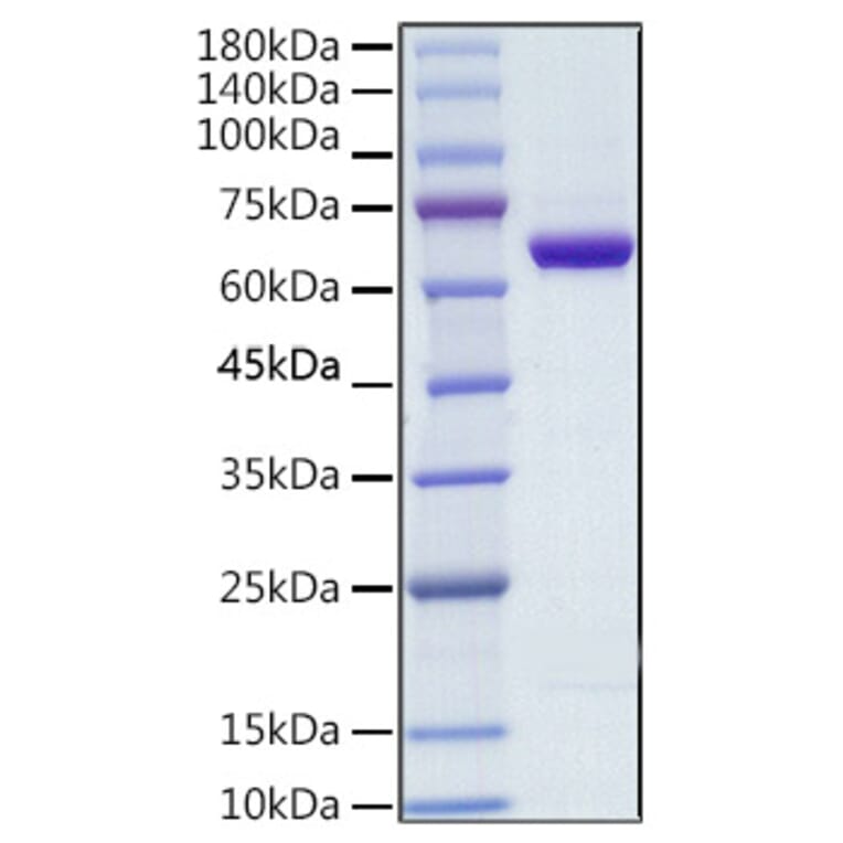 SDS-PAGE - Recombinant Human COX2 / Cyclooxygenase 2 Protein (C-terminal His Tag) (A330478) - Antibodies.com