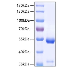 SDS-PAGE - Recombinant Human CPE Protein (C-terminal His Tag) (A330479) - Antibodies.com