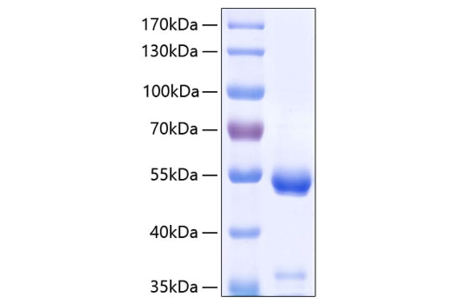 SDS-PAGE - Recombinant Human CPE Protein (C-terminal His Tag) (A330479) - Antibodies.com