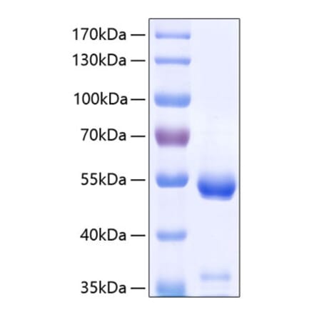 SDS-PAGE - Recombinant Human CPE Protein (C-terminal His Tag) (A330479) - Antibodies.com