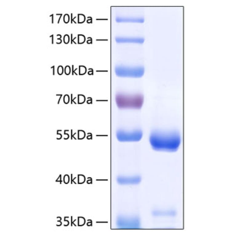 SDS-PAGE - Recombinant Human CPE Protein (C-terminal His Tag) (A330479) - Antibodies.com