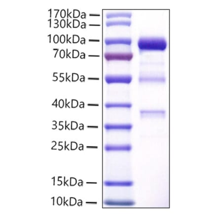 SDS-PAGE - Recombinant Human CPE Protein (C-terminal Human Fc and His Tag) (A330480) - Antibodies.com