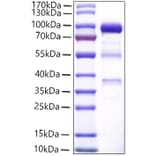 SDS-PAGE - Recombinant Human CPE Protein (C-terminal Human Fc and His Tag) (A330480) - Antibodies.com