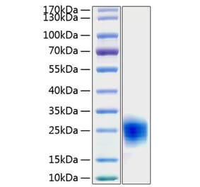 SDS-PAGE - Recombinant Human Cripto Protein (C-terminal His Tag) (A330481) - Antibodies.com