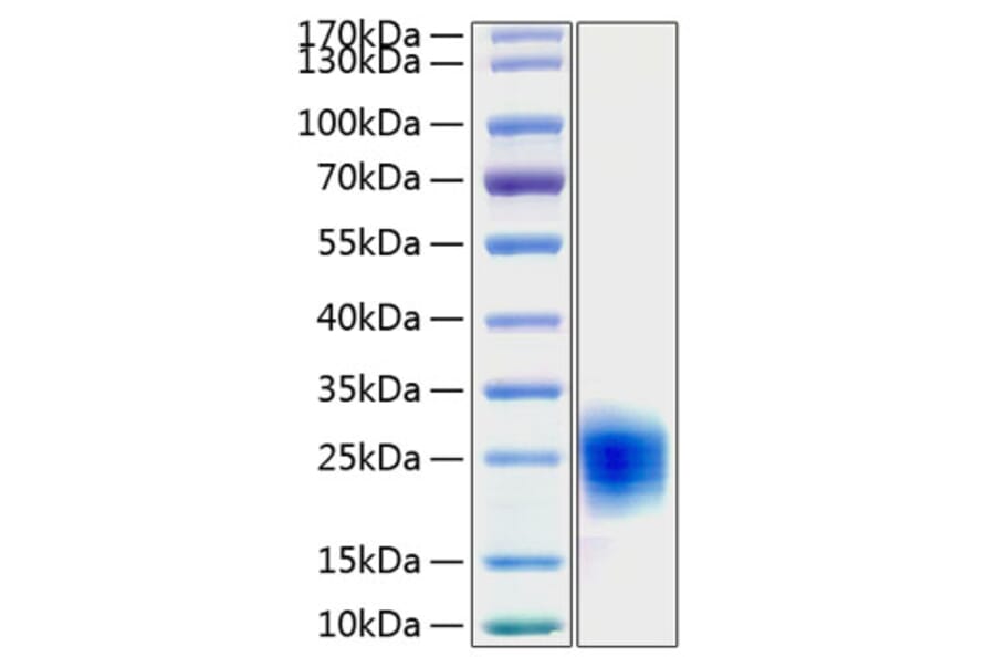 SDS-PAGE - Recombinant Human Cripto Protein (C-terminal His Tag) (A330481) - Antibodies.com