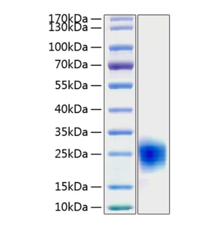 SDS-PAGE - Recombinant Human Cripto Protein (C-terminal His Tag) (A330481) - Antibodies.com