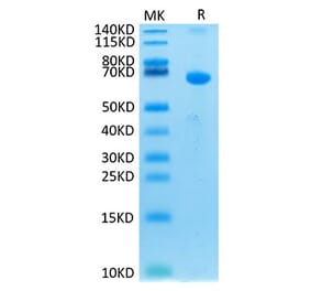 Tris-Bis PAGE - Recombinant Human CRLF2 Protein (C-terminal Human Fc Tag) (A330482) - Antibodies.com