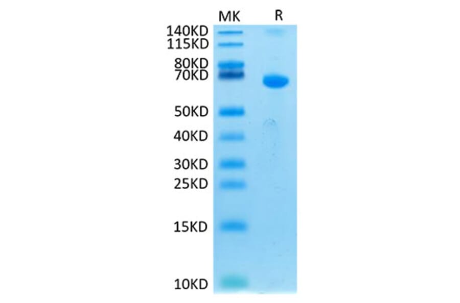 Tris-Bis PAGE - Recombinant Human CRLF2 Protein (C-terminal Human Fc Tag) (A330482) - Antibodies.com