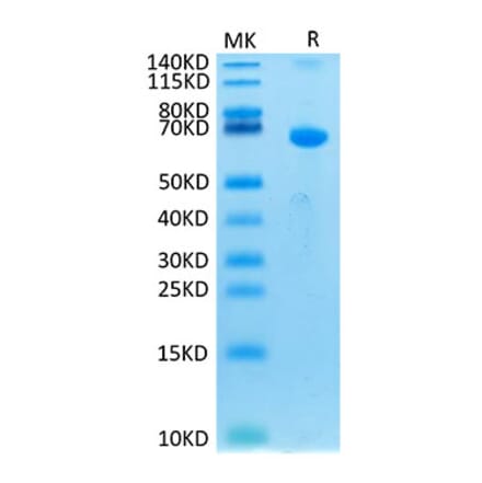 Tris-Bis PAGE - Recombinant Human CRLF2 Protein (C-terminal Human Fc Tag) (A330482) - Antibodies.com