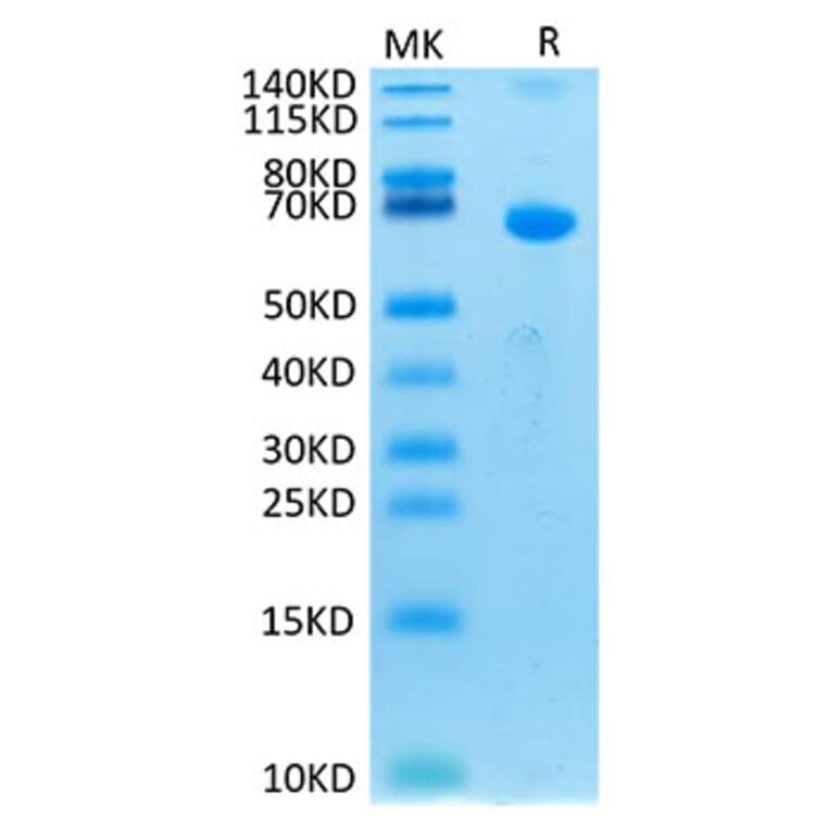 Tris-Bis PAGE - Recombinant Human CRLF2 Protein (C-terminal Human Fc Tag) (A330482) - Antibodies.com