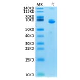 Tris-Bis PAGE - Recombinant Human CRLF2 Protein (C-terminal Human Fc Tag) (A330482) - Antibodies.com