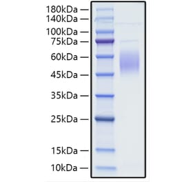 SDS-PAGE - Recombinant Human CRTAM Protein (C-terminal His Tag) (A330483) - Antibodies.com