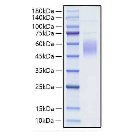 SDS-PAGE - Recombinant Human CRTAM Protein (C-terminal His Tag) (A330483) - Antibodies.com