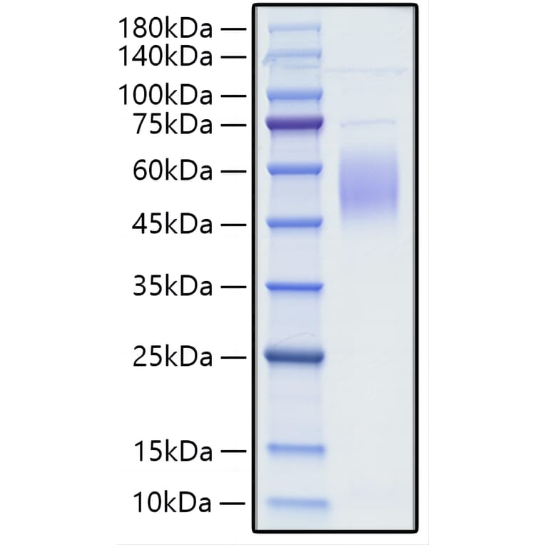 SDS-PAGE - Recombinant Human CRTAM Protein (C-terminal His Tag) (A330483) - Antibodies.com