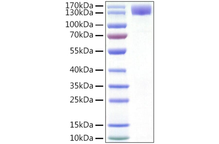 SDS-PAGE - Recombinant Human CSF-1-R Protein (C-terminal Human Fc and His Tag) (A330484) - Antibodies.com