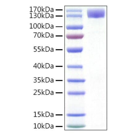 SDS-PAGE - Recombinant Human CSF-1-R Protein (C-terminal Human Fc and His Tag) (A330484) - Antibodies.com