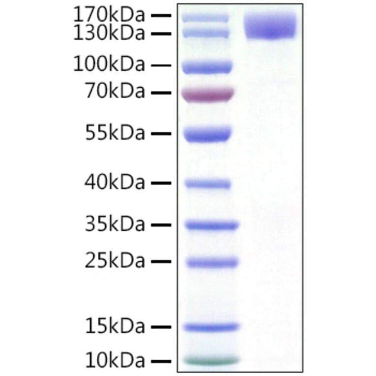 SDS-PAGE - Recombinant Human CSF-1-R Protein (C-terminal Human Fc and His Tag) (A330484) - Antibodies.com