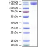 SDS-PAGE - Recombinant Human CSF-1-R Protein (C-terminal Human Fc and His Tag) (A330484) - Antibodies.com