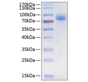 SDS-PAGE - Recombinant Human CSF-1-R Protein (C-terminal His Tag) (A330485) - Antibodies.com