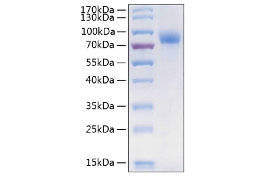 SDS-PAGE - Recombinant Human CSF-1-R Protein (C-terminal His Tag) (A330485) - Antibodies.com