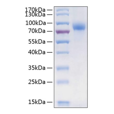 SDS-PAGE - Recombinant Human CSF-1-R Protein (C-terminal His Tag) (A330485) - Antibodies.com