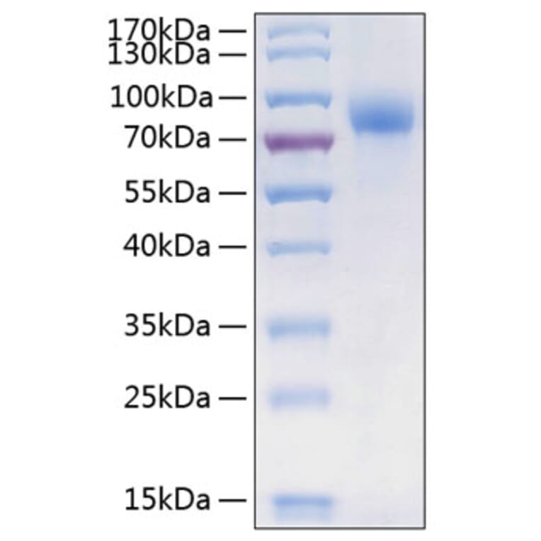 SDS-PAGE - Recombinant Human CSF-1-R Protein (C-terminal His Tag) (A330485) - Antibodies.com