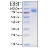 SDS-PAGE - Recombinant Human CSF-1-R Protein (C-terminal His Tag) (A330485) - Antibodies.com