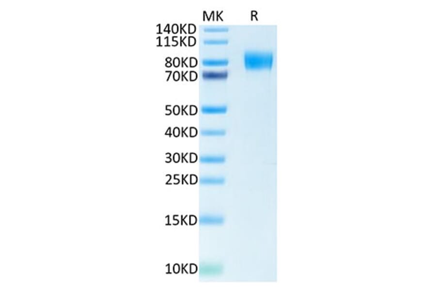 Tris-Bis PAGE - Recombinant Human CSF-1-R Protein (Biotin) (C-terminal His and Avi Tag) (A330486) - Antibodies.com