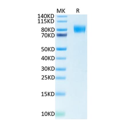 Tris-Bis PAGE - Recombinant Human CSF-1-R Protein (Biotin) (C-terminal His and Avi Tag) (A330486) - Antibodies.com