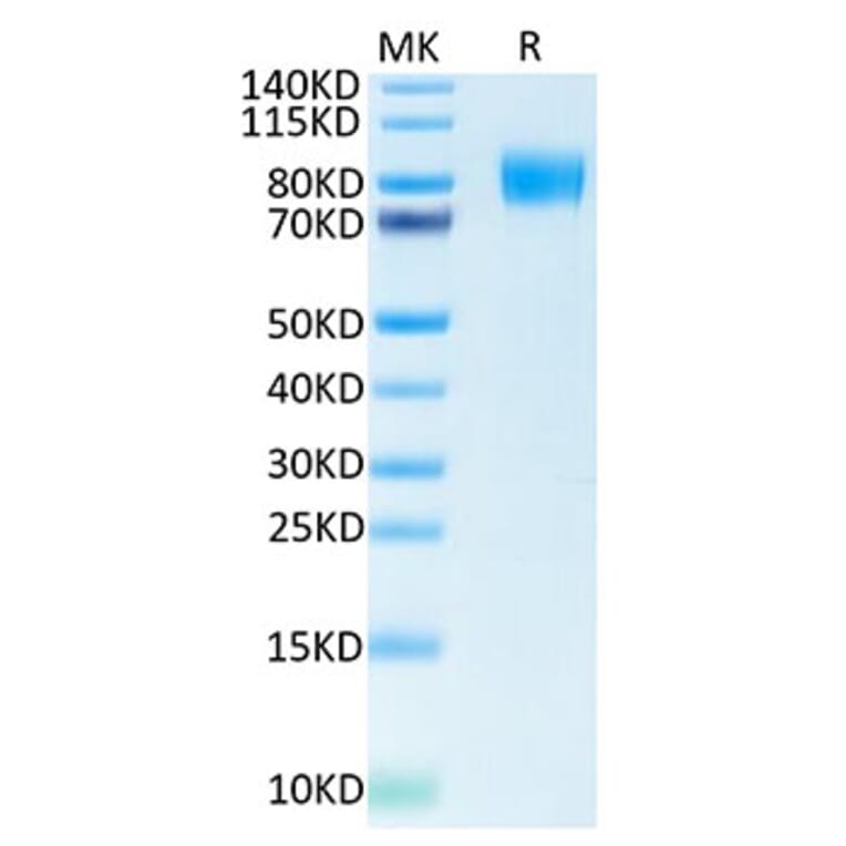 Tris-Bis PAGE - Recombinant Human CSF-1-R Protein (Biotin) (C-terminal His and Avi Tag) (A330486) - Antibodies.com