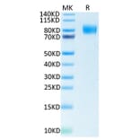 Tris-Bis PAGE - Recombinant Human CSF-1-R Protein (Biotin) (C-terminal His and Avi Tag) (A330486) - Antibodies.com