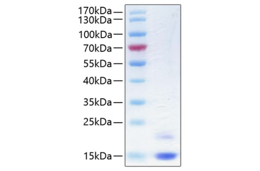 SDS-PAGE - Recombinant Human CST6 Protein (C-terminal His Tag) (A330487) - Antibodies.com