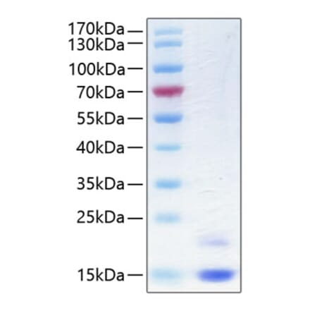 SDS-PAGE - Recombinant Human CST6 Protein (C-terminal His Tag) (A330487) - Antibodies.com
