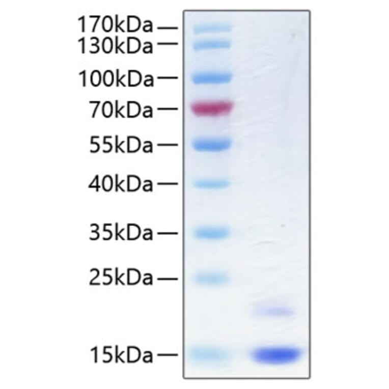 SDS-PAGE - Recombinant Human CST6 Protein (C-terminal His Tag) (A330487) - Antibodies.com