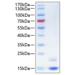 SDS-PAGE - Recombinant Human CST6 Protein (C-terminal His Tag) (A330487) - Antibodies.com