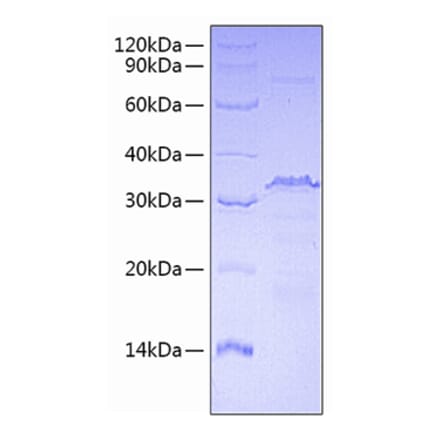 SDS-PAGE - Recombinant Human CTCF Protein (A330488) - Antibodies.com