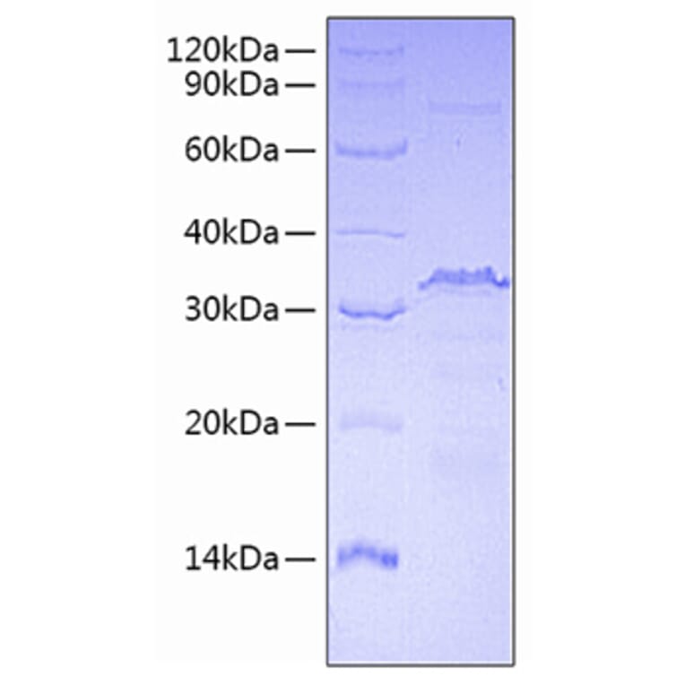 SDS-PAGE - Recombinant Human CTCF Protein (A330488) - Antibodies.com