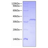 SDS-PAGE - Recombinant Human CTCF Protein (A330488) - Antibodies.com