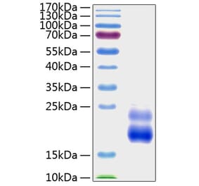 SDS-PAGE - Recombinant Human CTGF Protein (A330489) - Antibodies.com