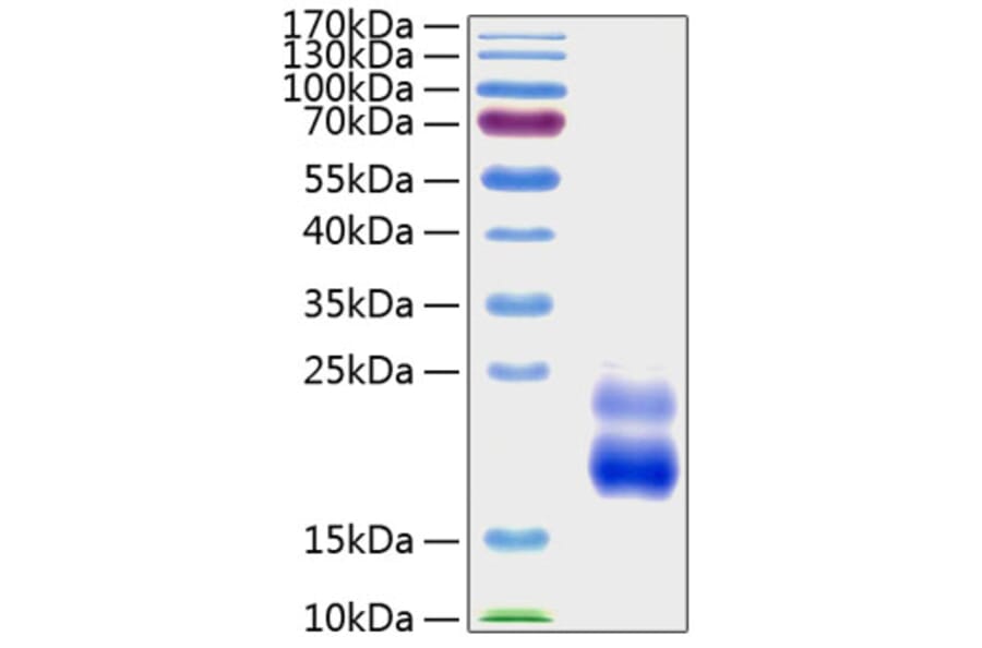 SDS-PAGE - Recombinant Human CTGF Protein (A330489) - Antibodies.com