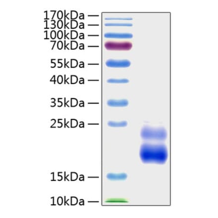 SDS-PAGE - Recombinant Human CTGF Protein (A330489) - Antibodies.com