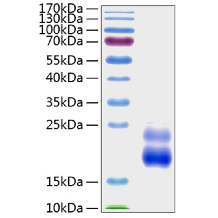 SDS-PAGE - Recombinant Human CTGF Protein (A330489) - Antibodies.com