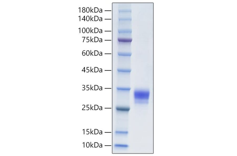 SDS-PAGE - Recombinant Human CTHRC1 Protein (C-terminal His Tag) (A330490) - Antibodies.com